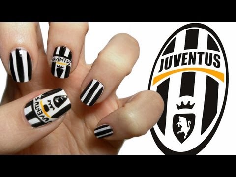 Mani bianconere su Higuain Mani bianconere su Gonzalo Higuain